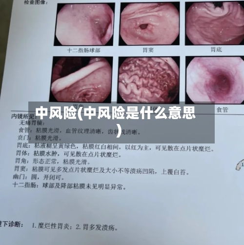 中风险(中风险是什么意思)-第1张图片