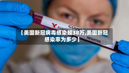 【美国新冠病毒感染超38万,美国新冠感染率为多少】-第1张图片