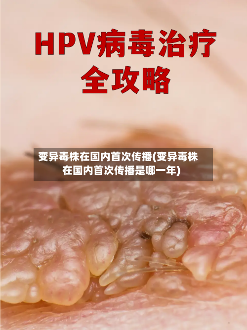 变异毒株在国内首次传播(变异毒株在国内首次传播是哪一年)-第2张图片