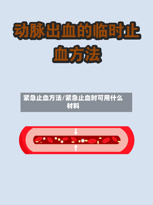 紧急止血方法/紧急止血时可用什么材料-第3张图片