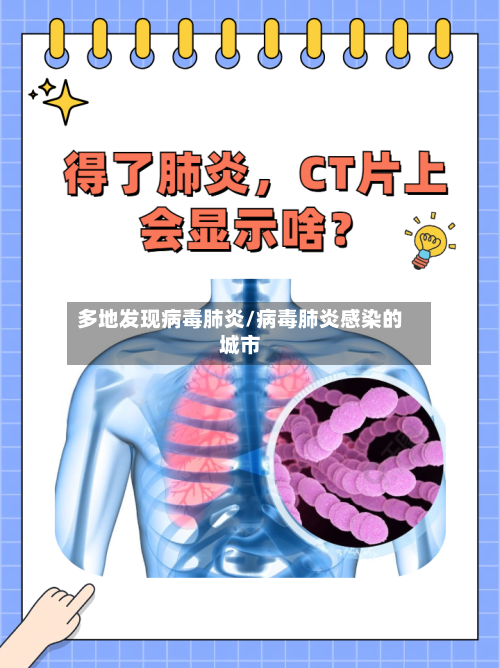 多地发现病毒肺炎/病毒肺炎感染的城市-第1张图片