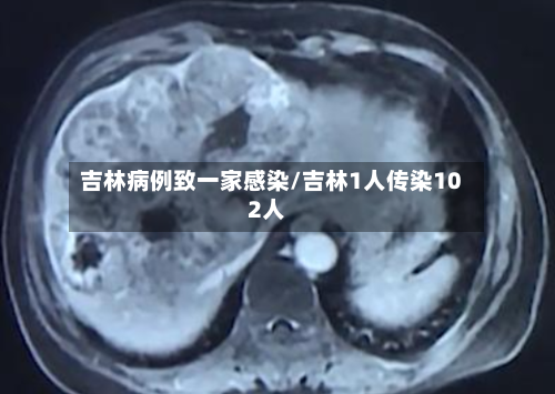 吉林病例致一家感染/吉林1人传染102人-第1张图片